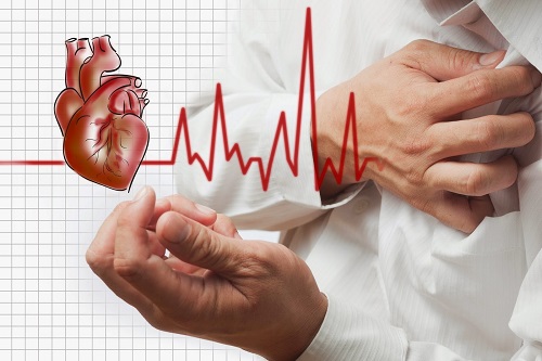 Bệnh nhân đột quỵ do thiếu máu cục bộ không có yếu tố nguy cơ được chẩn đoán trước đó được phát hiện có các bệnh lý tiềm ẩn trong hầu hết các trường hợp