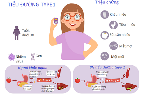 Nhiễm khuẩn có thể làm tăng nguy cơ mắc bệnh tim mạch vành ở bệnh nhân đái tháo đường týp 1